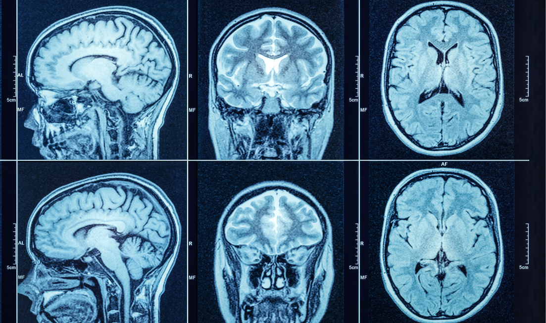 brain health imaging